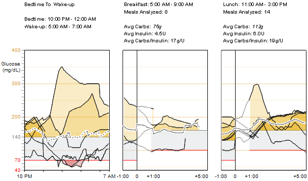 Szenzoros glükózmérés átfedő grafikonja lefekvéstől felkelésig és étkezési időszakok értékek és átlagok Lefekvéstől felkelésig A jelentési időszak azon napjain rögzített glükózgörbék egyesített