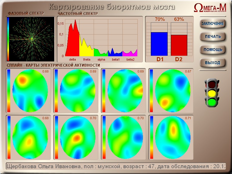 8.3 Az agyi biritmusk letérképezése A bal egérgmb segítségével válassza ki a páciens adatait az adatbázisból. (a kiválaszttt mérést sárga színnel jelöli).