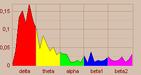 Fáziss spektrum ablak A színek a különböző ritmusknak felelnek meg, a szélességet a mduláció indexei határzzák meg, ami megfelel a spektrumt meghatárzó frekvenciáknak.