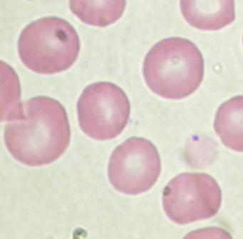 A magszerű elrendeződés során a durva granulumok a sejt közepén csoportosultak, ezáltal a vérlemezke magvas sejt benyomását keltette ( pseudonuclearis elrendeződés; 10A. ábra).