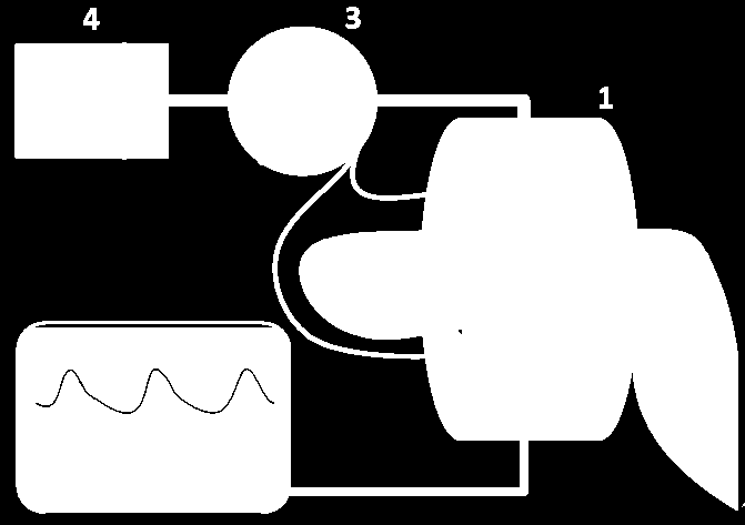 9. ábra. A Penaz-féle szervo-pletizmo mérés elve.