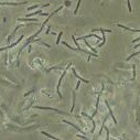 Mikrobiológiai kármentesítés: bioremediáció Rhodococcus sp.