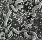 Helicobacter pylori H pylori egy spirális alakú baktérium, amely a gyomor