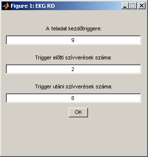 VERZIÓTÖRTÉNET EKG RD Elsőként az EKG_RD_event.m MATLAB scriptet készítettem el (7. ábra), mely a szívritmusváltozást hivatott ábrázolni, minél pontosabban.