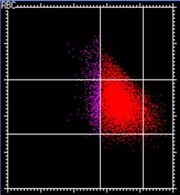 Volume (V) 0 28 41 50 g/dl Hgb Concentration (HC) Hypo