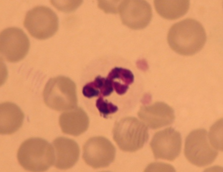 Neutrophil granulocyta Keringésben: 5-15 óra Utána apoptosis makrofágok eliminálják (efferocytosis) A gyulladás