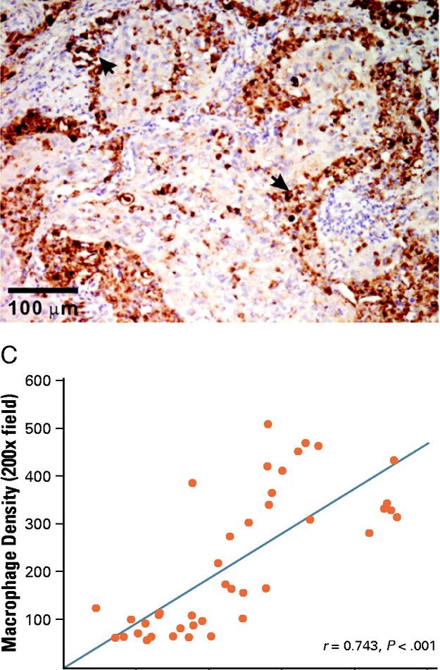 Tumor asszociált