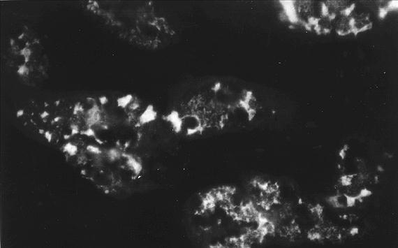 Immunológia 1.36.3.3. Immunfluoreszcencia (IF) Az IF széles körben elterjedt, igen érzékeny vizsgáló módszer, amely antigének és ellenanyagok kimutatására egyaránt alkalmas.