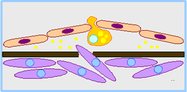 Hiperlipidémia és érelmeszesedés Hiperlipidémia: Koleszerin< 2mg/ml (5.2mmol/l), Triglicerid< 2mg/ml (2.