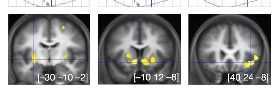 Jutalom és büntetés predikciója a humán agyban: a dopamin szerepe striatum insula L-dopa