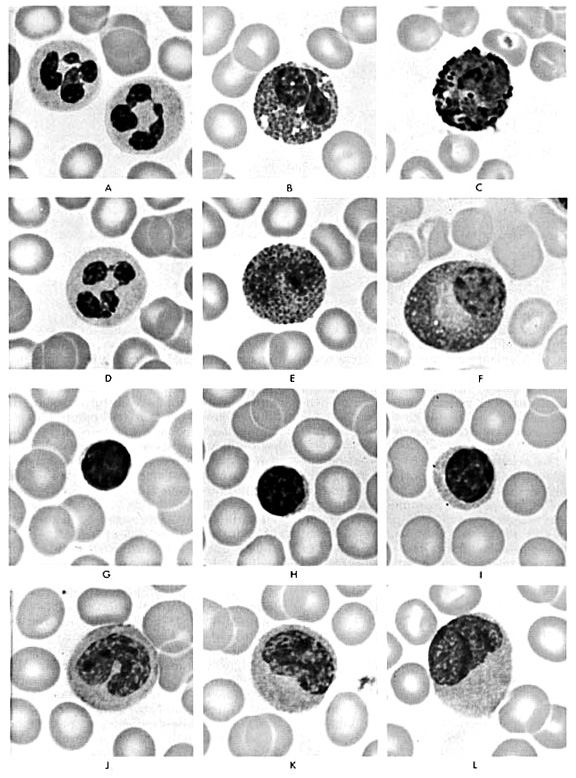 10. ábra: Festett vérkenetben megfigyelhetı fehérvérsejt típusok.