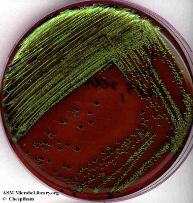 Escherichia