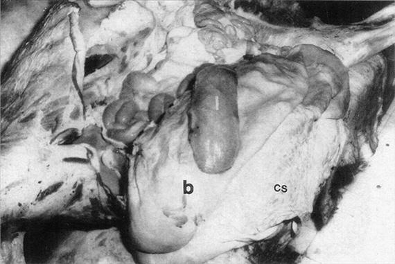 Az előgyomrok és az oltógyomor kivétele előtt az epésbelet közvetlenül az oltógyomor mögött egymástól kb. 10 cm-nyire két helyen lekötjük és a két lekötés között átvágjuk.