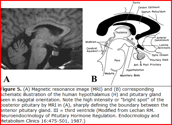 H-H MRI