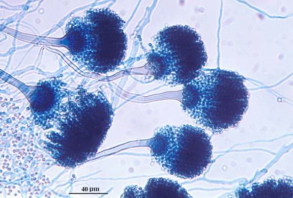 Histoplasma capsulatum