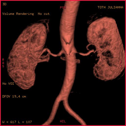 Renal