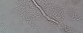 4.3.2. Éleszt9sejtek jelenlétének közvetlen hatása a konidium csírázásra A mikroszkópos vizsgálat során a Kl.