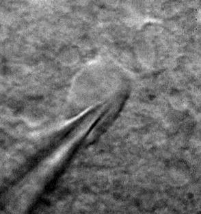 Vm (mv) One in vitro measurement 20 µm Rat hippocampal