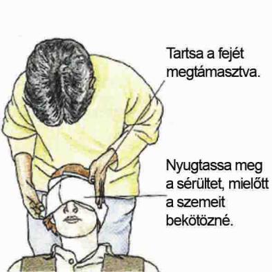 Idegentest Szemben: A nagyobb méretű idegentestet ne távolítsuk el, mindkét szemet fedjük le. A testbe hatolva: TILOS eltávolítani, mert az eltávolítása után súlyos vérzés léphet fel.