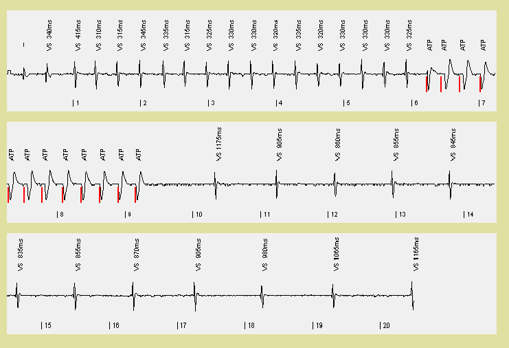 Sikeres VT