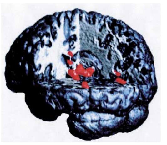 INTRAVENOUS ADMINISTRATION Three-dimensional reconstruction of a [ 11 C]vinpocetine uptake image in the brain Time-activity curves of regional uptake of [ 11 C]vinpocetine in brain regions after