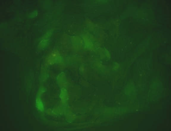 A pcdna-egfp vektorral stabilan transzfektált sejteket szelekciós ágenst (geneticint) nem tartalmazó médiummal osztottuk le, majd 50-70% konfluenciánál a sejteket pcdna-cre expressziós plazmiddal