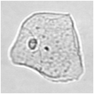 Azonosítás: méret SQEP HYAL GRAN CELL EPIC TREP NSE BYST W BC REEP BACT URIC