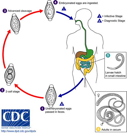 A Trichuris