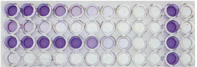 ELISA (enzyme linked immunosolvent assay) T Antigén vagy antitest jelenlétének megállapítása +/- Élelmiszer allergének kimutatása +/- Drog