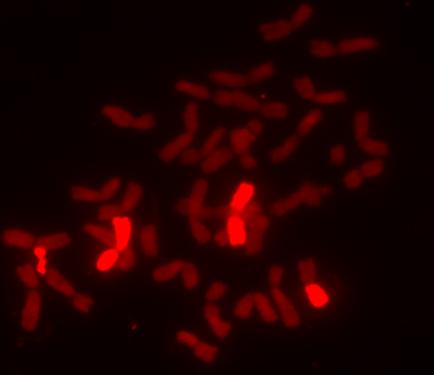 Fiber-FISH Fluorescence in situ hybridization to DNA fibers Az in situ hibridizáció alkalmas arra, hogy