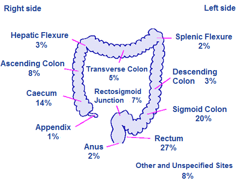 Flexibilis sigmoidoscopia