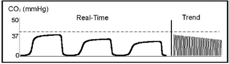 etco 2 változása izomaktivitás hyperthermia cardiacoutput (CPR alatt is!) bikarbonát iv.