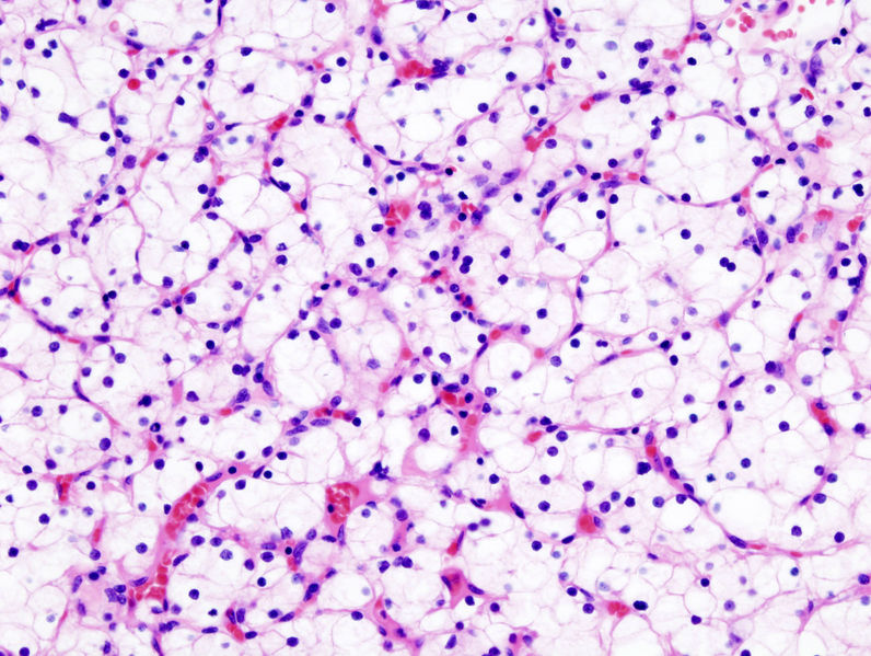 Hematoxilin és Eozin festés (H&E) Hematoxilinnal előbb bazofil festést végzünk. Ekkor a DNS-t és RNS-t tartalmazó sejtkomponensek és ha jelen vannak a savanyú mukopoliszacharidok festődnek.