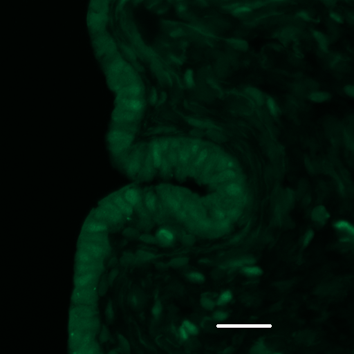 immunfluorescensz vizsgálattal az epithelialis felszín sejtjeiben. (scale bar 30 µm). a b 6.