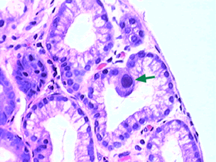 különbözı technikákkal próbálják elkerülni: a mintát rácentrifugálják a szövetre (a vírus szövet-adszorpciója nı); immunfluorescens módszerrel jelölik a CMV antigéneket (pl.