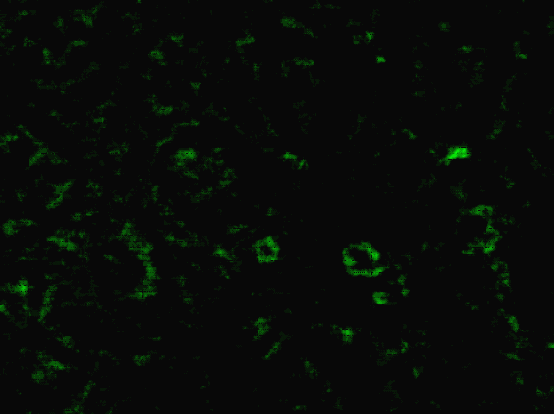 // Eozin festéssel immunsejtek (nyílhegy) mutathatók ki az érfalban és a lamina propriában.