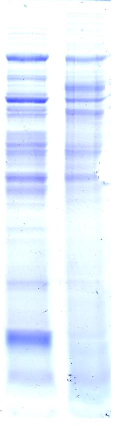 populáció között. A temporális lebeny-dienkefalon komplex esetében 35-55 kda között találtunk hat olyan fehérjét (kb. 35, 36, 37, 40, 47, 55 kda), amely jelentős intenzitásbeli eltérést mutatott.