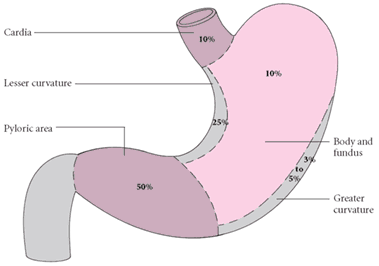 Gastric Cancer http://www.rnpedia.