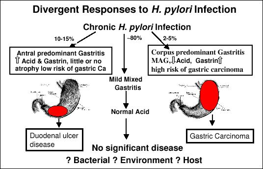 Gastric Cancer Role of H. pylori http://www.jpp.