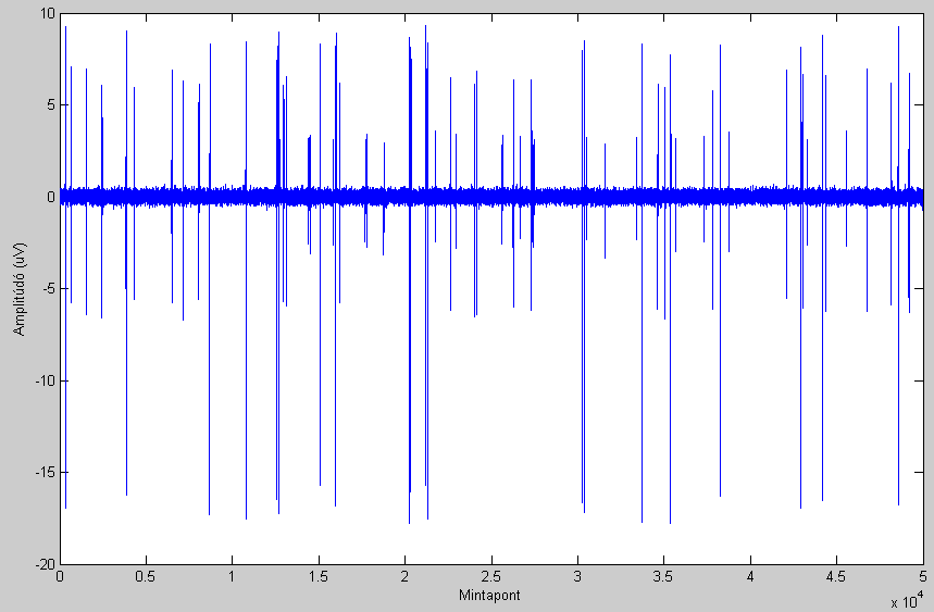 8. ábra A három spike által generált jel szuperponálásával keletkezett jelsorozat Ezek után a keletkezett három jelet összeadtam, majd hozzáadtam 25 db értékű Gaussi fehérzajt, és így már a