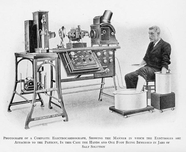 ELEKTROKARDIOGRAM (EKG) A szív elektromos jelenségeit vizsgálja a szívizom összehúzódásakor keletkező elektromos feszültség