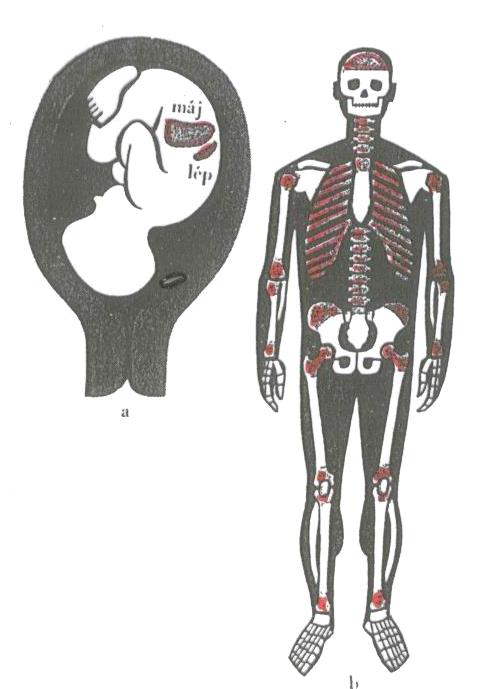 A VÉRSEJTKÉPZŐDÉS Magzatban (a) a csontvelőn kívül a máj és a lép, felnőttben(b)