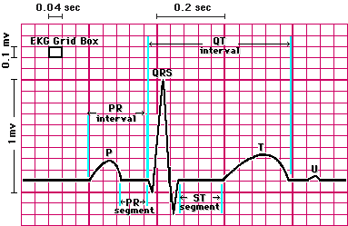 KESKENY QRS-Ű