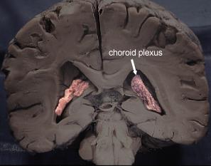 Ependima choroid plexus 1918, Gray s anatomy