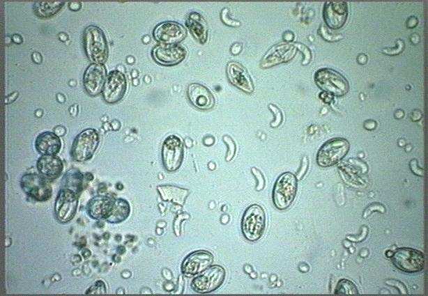 Isospora belli, Cyclospora cayetanensis Differential diagnosis Cryptosporidium Cyclospora Isospora Pathogenesis is poorly known, histopathology is similar to Cryptosporidium (villous atrophy, crypt