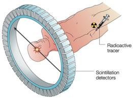 0.05.08. Diagnoztikai ódzerek II. Pozitron eizió toográfia (PT) Diagnoztikai ódzerek II. PT,MRI Kardo Roland 0 05.