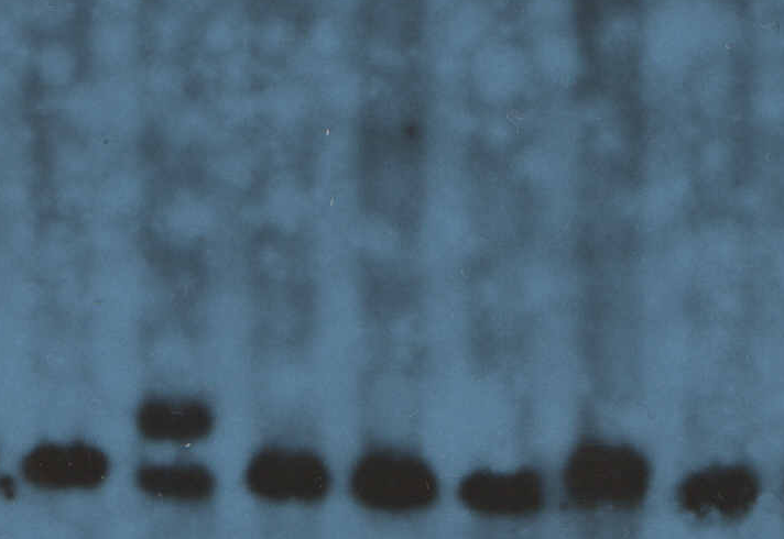 Southern blot analízis EcoRI+ EagI