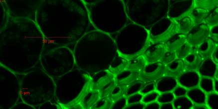 3D fluoreszcencia mikroszkópia