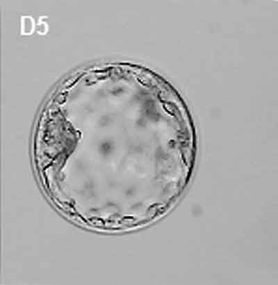 Pu Zhang, Marco Zucchelli, Sara Bruce, Fredwell Hambiliki, Anneli Stavreus-Evers, Lev Levkov, Heli Skottman, Erja Kerkelä, Juha Kere, Outi Hovatta Transcriptome profiling of human pre-implantation