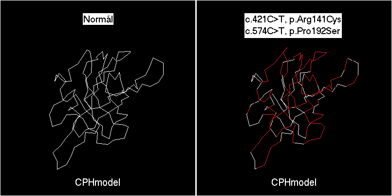 A 4. család II/2. betegben egyszerre két missense mutáció, egy de novo (c.421c>t, Arg141Cys) és egy anyától örökölt (c.574c>t, Pro192Ser) mutáció együttes jelenlétét sikerült kimutatni.